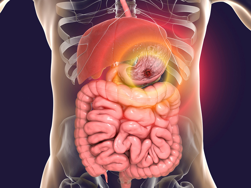 Gastroenterology