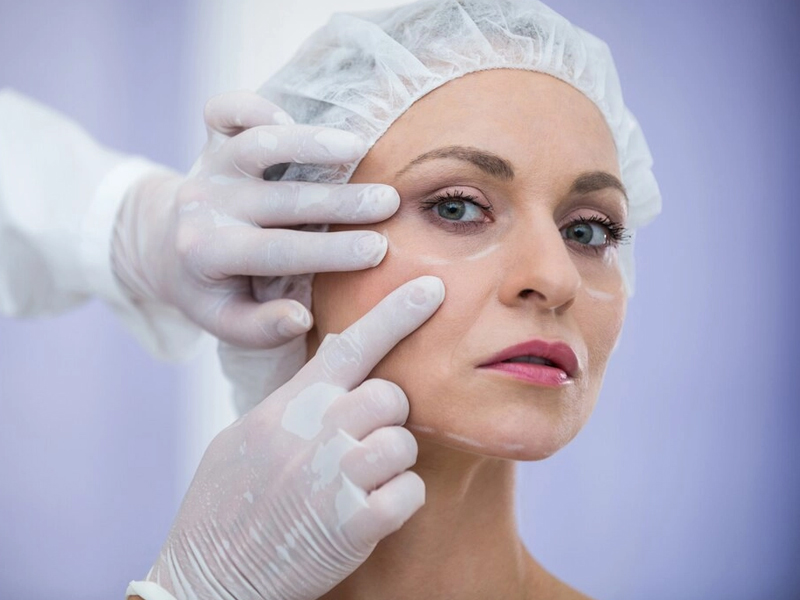Plastic Surgery